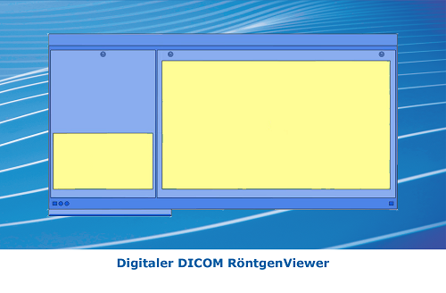 DICOM RntgenViewer